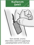Siltape Soft Silikon Yara İzi Dikiş İzi Sezaryen Yanık Estetik Bant 2 CM x 3 M - 5