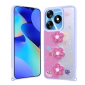 Tecno Spark 10 4G Kılıf Parlayan Simli Kabartma Figürlü Zore Cevze Kapak thumbnail 6