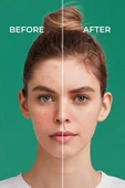 SİNOZ Spf50 Pure Cica Anında Ton Eşitleyici Yüz Bakım Kremi - Yeni Nesil Mineral Güneş Filtresi - 6