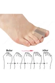 HT SAĞLIK Ayak Parmağı Düzeltici haluks halluks valgus bunyon makara thumbnail 6
