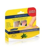 ALLDERMO AYAK VE TOPUK BAKIM KREMİ 60 GR - 1