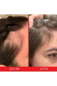 HAIRTAMİN Advanced Formula 30 Vegan Kapsül - Saç Vitamini - 4