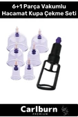 Premium Series Selülit Çatlak Giderici Vakumlu Masaj Aleti 6'lı Kupa Hacamat Seti - 1