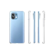 Xiaomi Mi 11 - Kılıf Şeffaf Soft Slim Fitt Süper Silikon Kapak - 4