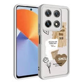 İnfinix Note 30 Pro - Kılıf Kamera Korumalı Baskılı Arka Yüzey Klas Kapak - 2