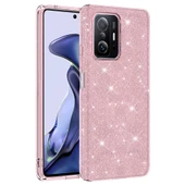 Xiaomi Mi 11T 5G - Kılıf Simli Koruyucu Shining Silikon - 1