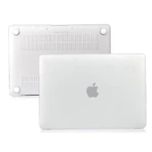 Macbook Kılıf MacBook Air Kılıf 11inç A1370 A1465 ile Uyumlu Mat - 2