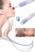 Pore Cleaner Vakumlu Yüz Temizleme Siyah Nokta Temizleme Cihazı - 2