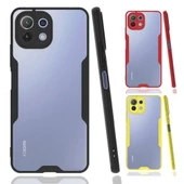 Xiaomi Mi 11 Lite Kılıf Platin Matte Silikon Arka Kapak - 1
