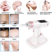 Yeni Nesil Mezoterapi Tabancası Yüz Sıkılaştırma Saç Yenileme Cilt İz Kırışıklık Leke Giderme Cihazı thumbnail 4