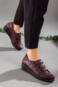 Cırtlı Cilt Bordo Kadın Dolgu Taban Günlük Ayakkabı thumbnail 2