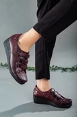 Cırtlı Cilt Bordo Kadın Dolgu Taban Günlük Ayakkabı thumbnail 1