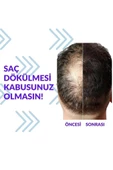 Pak Darou Minioxidil Minoxidil %5 Minoksil Pak Darou - 1