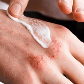 Ducray Dexyane Creme Emolliente Kaşıntı Karşıtı Krem 200 ml thumbnail 3