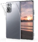 Xiaomi Redmi Note 10 4g Tıpalı Şeffaf Silikon thumbnail 2