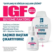 Alopecia Kadın Procapil Ve Igf Içerikli Serum Ve Şampuan - 4