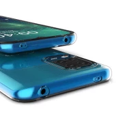 Xiaomi Mi 10 Lite Ultra İnce Şeffaf Silikon İnce Sararmaz Kılıf thumbnail 4