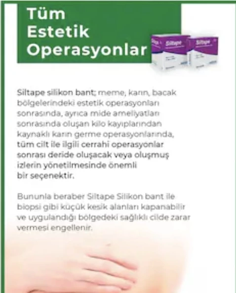 Siltape Soft Silikon Yara İzi Dikiş İzi Sezaryen Yanık Estetik Bant 2 CM x 3 M - 4