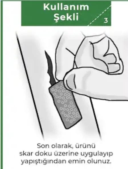 Siltape Soft Silikon Yara İzi Dikiş İzi Sezaryen Yanık Estetik Bant 2 CM x 3 M - 5