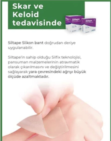 Siltape Soft Silikon Yara İzi Dikiş İzi Sezaryen Yanık Estetik Bant 2 CM x 3 M - 3
