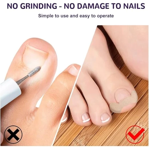 Ayak Tırnağı Düzeltme Bandı 50 Adet - 2