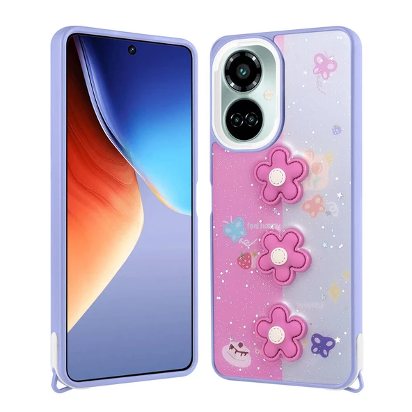 Tecno Camon 19 Pro Kılıf Parlayan Simli Kabartma Figürlü Zore Cevze Kapak - Resim 5