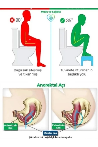 akçehome Klozet Çömelme Ayak Taburesi, Wc Basamak, Wc Tuvalet Taburesi, Klozet Ayaklığı - Resim 5