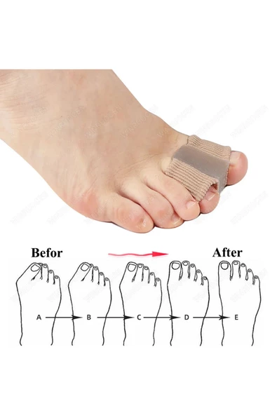 HT SAĞLIK Ayak Parmağı Düzeltici haluks halluks valgus bunyon makara - Resim 6
