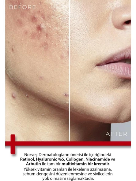 Todays Clinicals Onarıcı Krem 100ml+De femme Saç Proteini Hediyeli - 5