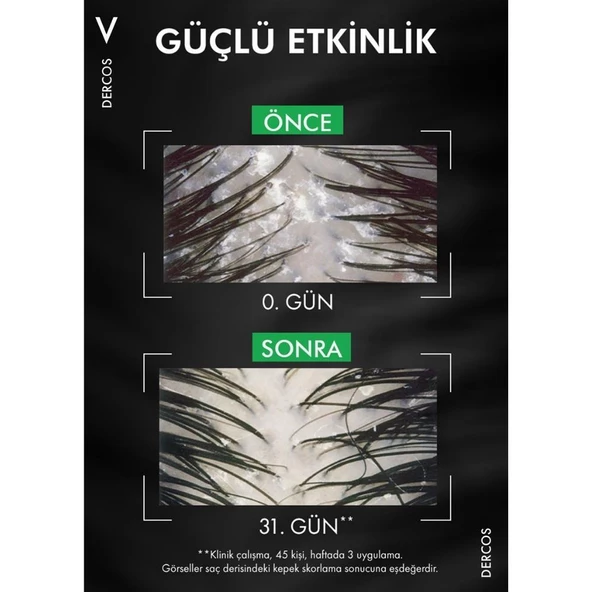 Vichy Dercos Kepek Karşıtı Şampuan 75ml - 6