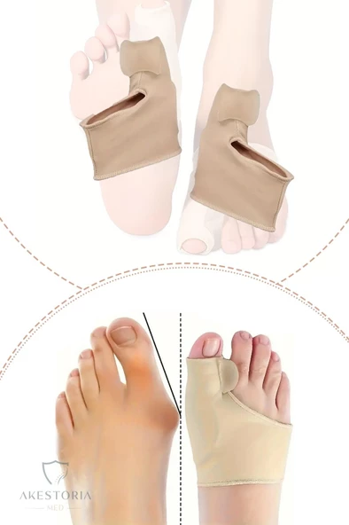 Çift Baş Parmak Kemik Düzeltici Ve Koruyucu Makarlı Unisex FC-038 - 4