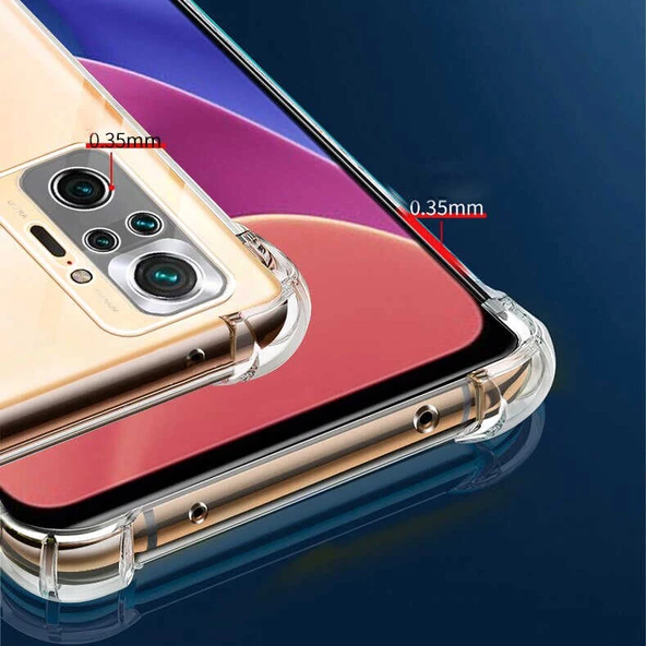 Xiaomi Redmi Note 10 Pro Kılıf Nitro Anti Shock Darbe Emici Köşe Korumalı Şeffaf Silikon Kapak - 3