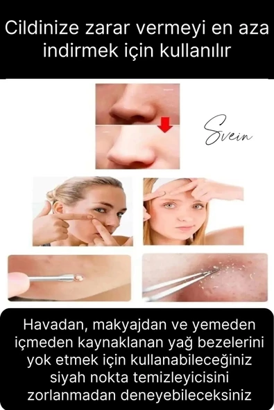 Siyah Nokta Akne Temizleyici Giderici Çıkarıcı Komedon 4'lü Set Kutulu Yağ bezesi Sivilce İğnesi - 3