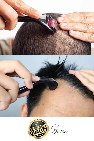 Profesyonel Cilt Bakımı Derma Roller Titanyum İğneli Saç Derisi Sakal Uzatma Büyütme Bıyık Çıkartma - 6