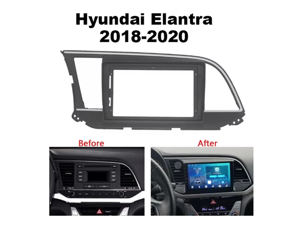 Hyundai Elantra Multimedya (2018-2020) 2 GB RAM 32 GB Hafıza 4 Çekirdek Nakamichi - Resim 11