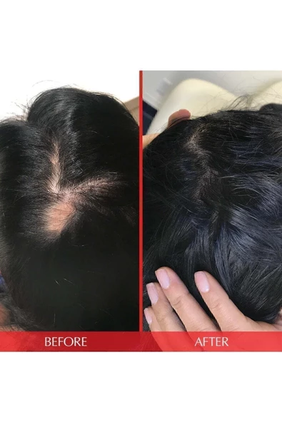 HAIRTAMİN Advanced Formula 30 Vegan Kapsül - Saç Vitamini - 2
