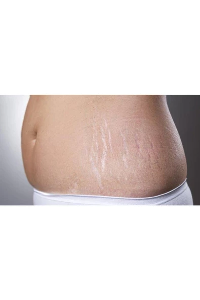 Çatlak Önleyici Krem 100 ml - 3