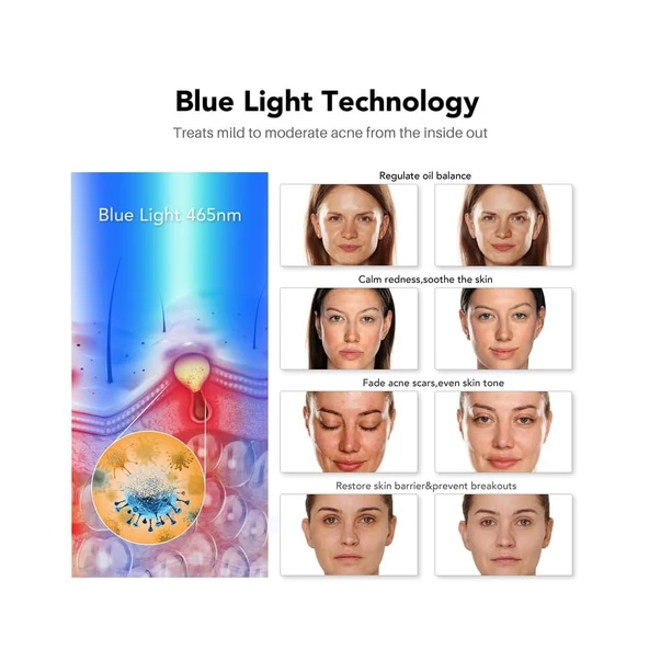 NEWKEY bakım için Mavi Işık Terapisi 7 Renk LED Yüz Maskesi - 4