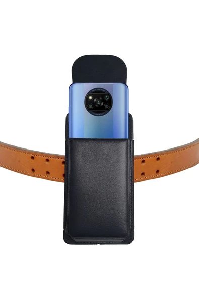 Poco X3 Nfc Uyumlu Kemer Kılıfı