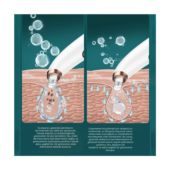 Neutron Su Hazneli Şarjlı Vakumlu Siyah Nokta  NTL-0078 - 3