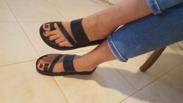 VOGA 1740 SİYAH ÇATLAK COMFORT CASUAL ANATOMİK BAYAN TERLİK - 2