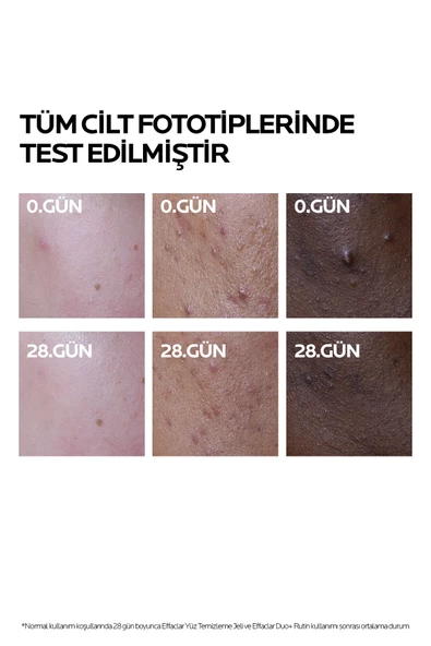 La Roche Posay Effaclar Duo + Cilt Kusuru Görünümü Karşıtı Akneye Eğilim Gösteren Ciltler İçin Bakım Kremi 40 ml - 3