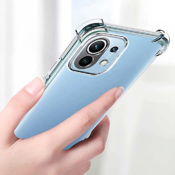 Xiaomi Mi 11 Lite - Kılıf Kamera Korumalı Nitro Anti Shock Silikon - Resim 7