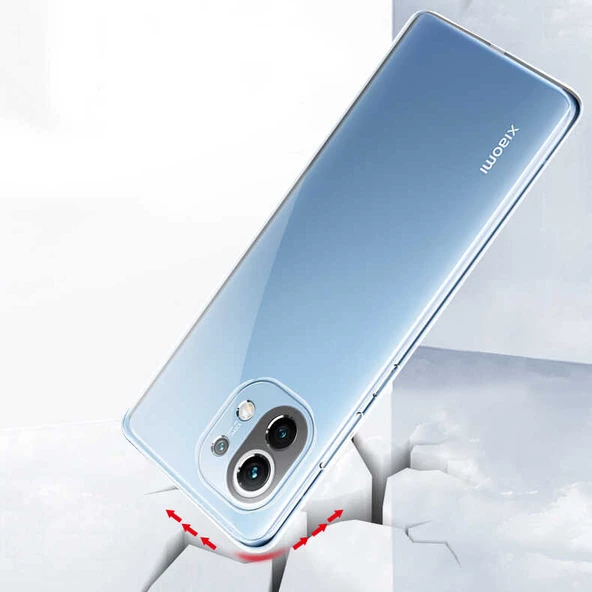 Xiaomi Mi 11 Lite - Kılıf Kamera Korumalı Süper Silikon Kapak - Resim 6