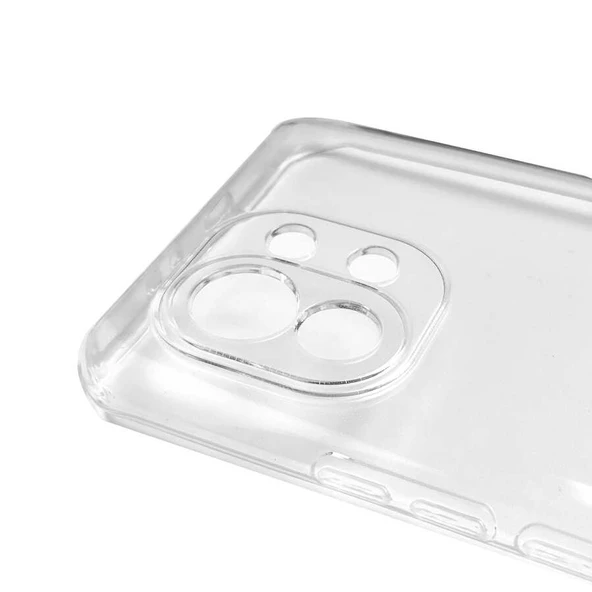 Xiaomi Mi 11 - Kılıf Kamera Korumalı Süper Silikon Kapak - Resim 2