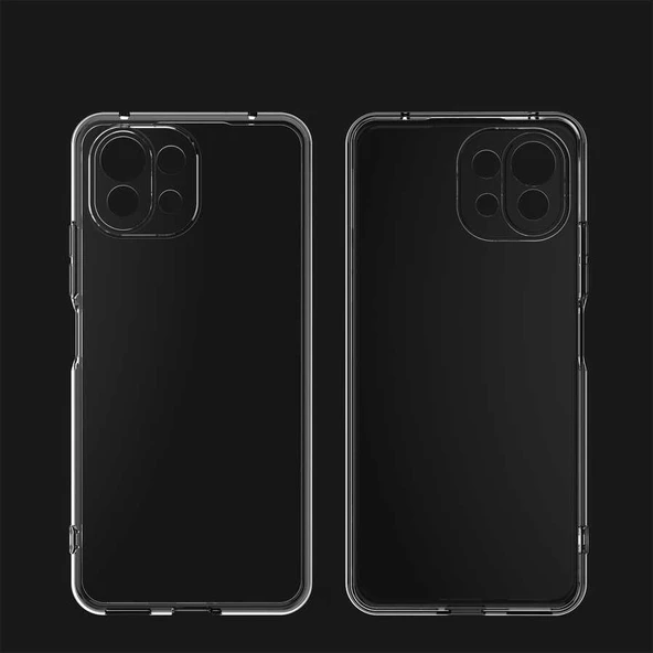 Xiaomi Mi 11 - Kılıf Kamera Korumalı Süper Silikon Kapak - Resim 4