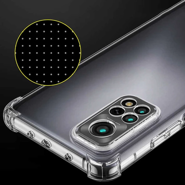 Xiaomi Redmi Note 11S Global - Kılıf Kamera Korumalı Nitro Anti Shock Silikon - Resim 2