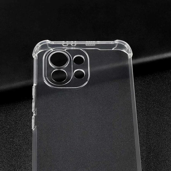 Xiaomi Mi 11 Lite - Kılıf Kamera Korumalı Nitro Anti Shock Silikon - Resim 5