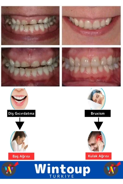 Premium Seri Bruxism Çene Sıkma Diş Gıcırdatma Koruyucu Aparatı Dişlik Gece Plağı Dişlik - 2