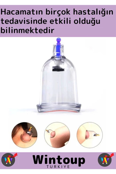 Özel Üretim Yüksek Kaliteli Selülit Çatlak Giderici Vakumlu 7 Numara Hacamat Kupası 50 Adet - 3